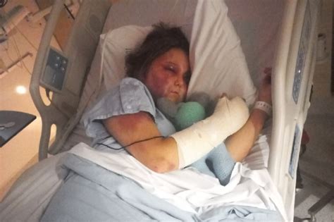 kirra hart friends|Teen victim of brutal alleged bashing speaks out。